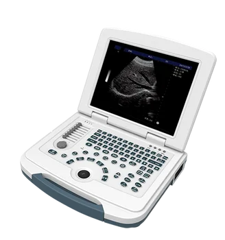 Самый дешевый по цене ноутбук цифровой 15-дюймовый 2D 3D 4D акушерский гинекологический ультразвуковой сканер, медицинские ультразвуковые инструменты
